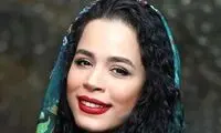 ملیکا شریفی‌‌نیا با چهره پانسمان‌شده در تلویزیون