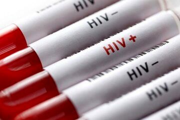 هشدار! زنگ خطر تغییر الگوی انتقال ایدز به صدا درآمد