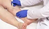 معجزه درمان مشکلات عروقی (از واریس تا لخته خون)