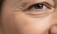 چرا پوست شما با افزایش سن چروک می‌شود؟