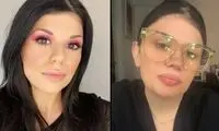 این زن، ۵ اندام اضافی در بدن خود دارد
