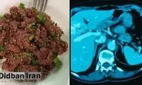 این غذا هر سال هزاران نفر را به کام مرگ می‌کشاند