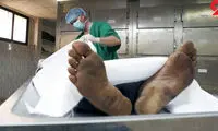مرگ تلخ زن جوان هنگام زیر تیغ جراحی کیسه صفرا