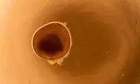 انقلابی بزرگ در درمان نابینایی