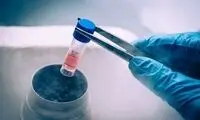 امتیاز فریز تخمک برای دختران بالای 30سال