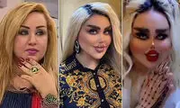 زنی که بیش از ۵۰ عمل زیبایی انجام داده تا شبیه عروسک باربی شود