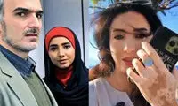 درددل بازیگر ساختمان پزشکان؛ «گفتند ویتیلیگو گرفتی»