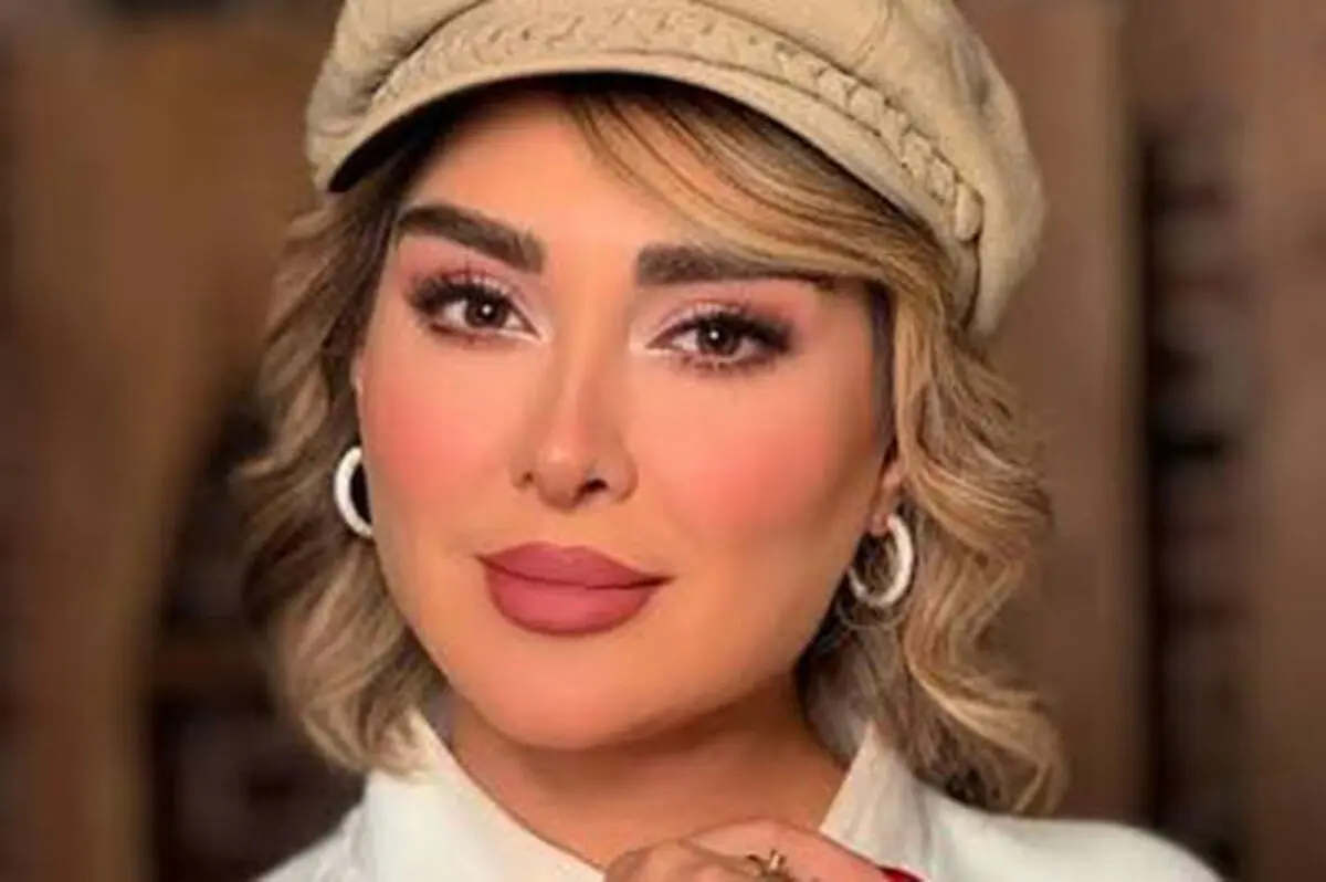 کنایه سنگین کاربران به تغییر چهره الهام حمیدی