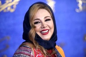 فیلترهای اینستاگرام، چهره جدیدی برای بهنوش بختیاری ساخت!