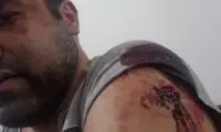مجروح شدن استاد دانشگاه توسط مزاحمین چند زن