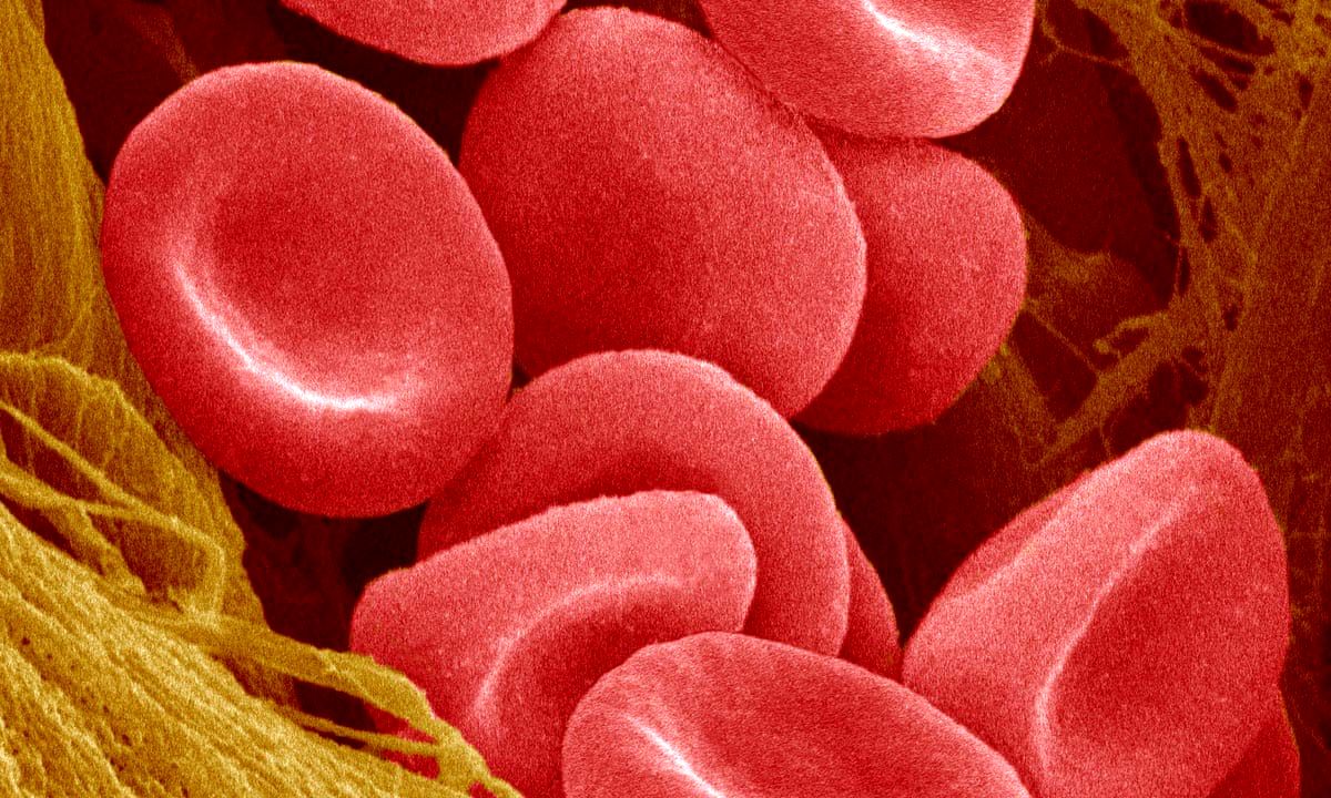 تزریق بی‌سابقه خون آزمایشگاهی به انسان