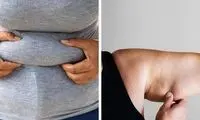 نوع چربی بدن درباره سلامت تان چه می گوید؟