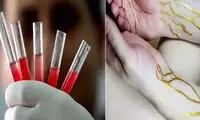 شناسایی ۱۰ نفر با گروه خونی طلایی در ایران!