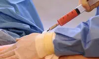 تزریق چربی به باسن چیست و چه مزایایی دارد؟