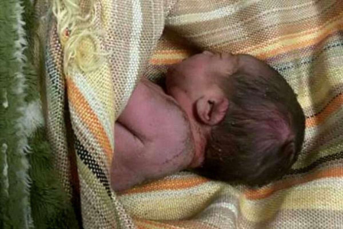 روایت تلخ از دفن کودک ۱۰ ماهه در آغوش مادر
