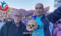 ترسناکترین صحنه در فوتبال؛ یک جمجمه در فینال کوپا آمریکا