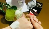 عکسی عجیب از جشنِ دونفره عملِ دماغ!