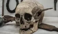 سربازی که سرش سوراخ شد!