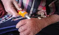 ماجرای رها شدن یک نوزاد پروانه‌ای در بیمارستان