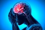 این گروه بیش از دیگران در خطر سکته مغزی هستند
