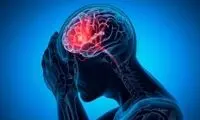 این گروه بیش از دیگران در خطر سکته مغزی هستند