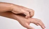 این بیماری پوستی ناشی از ریزگردها است 
