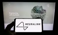 نورالینک مجوز انجام آزمایش انسانی را اخذ کرد!