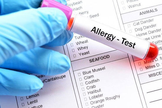 تست آلرژی چیست؟