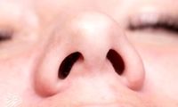 اگر فقط یک سوراخ بینی داشتیم چه می‌شد؟