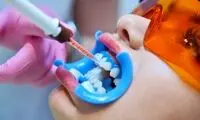 بهترین مرکز بلیچینگ دندان حرفه‌ای در تهران؛ ۵ کلینیک برتر