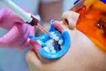 بهترین مرکز بلیچینگ دندان حرفه‌ای در تهران؛ ۵ کلینیک برتر