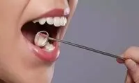 سپری طبیعی برای محافظت از دندان‌ها ساخته شد