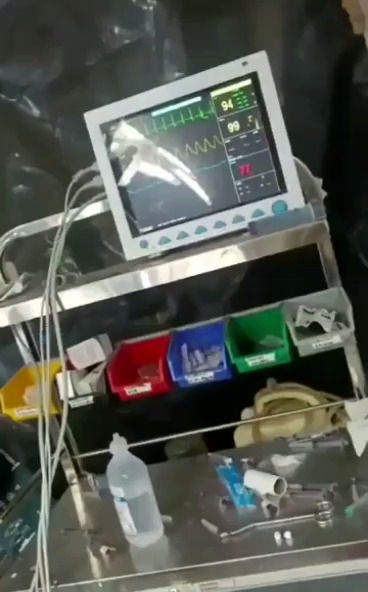 لحظه زلزله ۷/۷ ریشتری حین جراحی یک بیمار