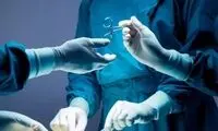 مرگ زن جوان بعد از عمل پیکرتراشی