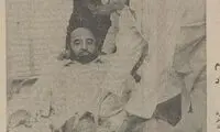 اولین مشتری طب‌سوزنی در ایران که بود؟