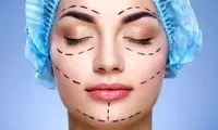 ایران و بازار داغ جراحی‌های زیبایی؛ نگاهی به پرتقاضاترین عمل‌ها