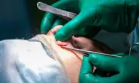 جراحی زیبایی در ایران دیگر سن‌و‌سال نمی‌شناسد