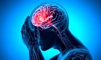 علائم خونریزی مغزی چیست؟