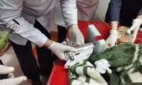 قطع انگشتان دختربچه ٢ساله با چرخ گوشت