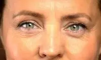 خط اخم را با این 10 روش خانگی راحت از بین ببر! 