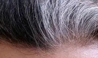 چه کار کنیم بعد از ۳۰ سالگی هم موهای پرپشت داشته باشیم؟