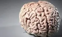 یافته‌ای حیرت‌آور از واکنش مغز به این سبک موسیقی