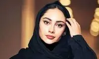 پاسخ خبرساز ترلان پروانه درباره انجام عمل زیبایی