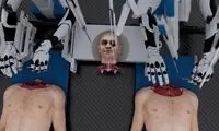 رونمایی از طرح پیوند سر مصنوعی با بدن انسان