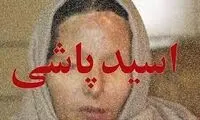 ماجرای مصوبه تشدید مجازات اسیدپاشی