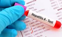 هشدار شیوع بالای هپاتیت A در کودکان و نوجوانان ایرانی