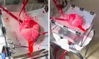ویدئوی شگفت‌انگیز از ضربان قلب در خارج از بدن