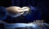 کنده شدن بینیِ یک دختر در مطب زیبایی
