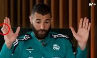 وایرال شدن عکسی از انگشت بنزما بدون بانداژ