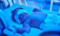 نظر متخصصان درباره حجامت لاله گوش نوزاد